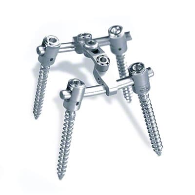 S4® Spinal System-Produktbild Vergrößerung CW