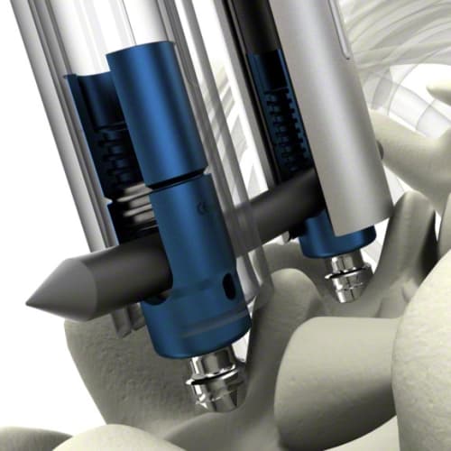 S4® Spinal System-Produktbild Vergrößerung CW