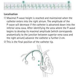 Localisation-Produktbild Vergrößerung CW