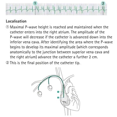 Localisation-Produktbild Vergrößerung CW