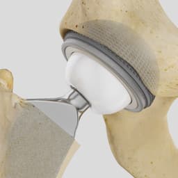 Isocer®-Produktbild CW Vergrößerung