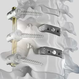 CeSPACE® 3D-Produktbild CW Vergrößerung