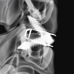 Arcadius XP C®-Product Picture