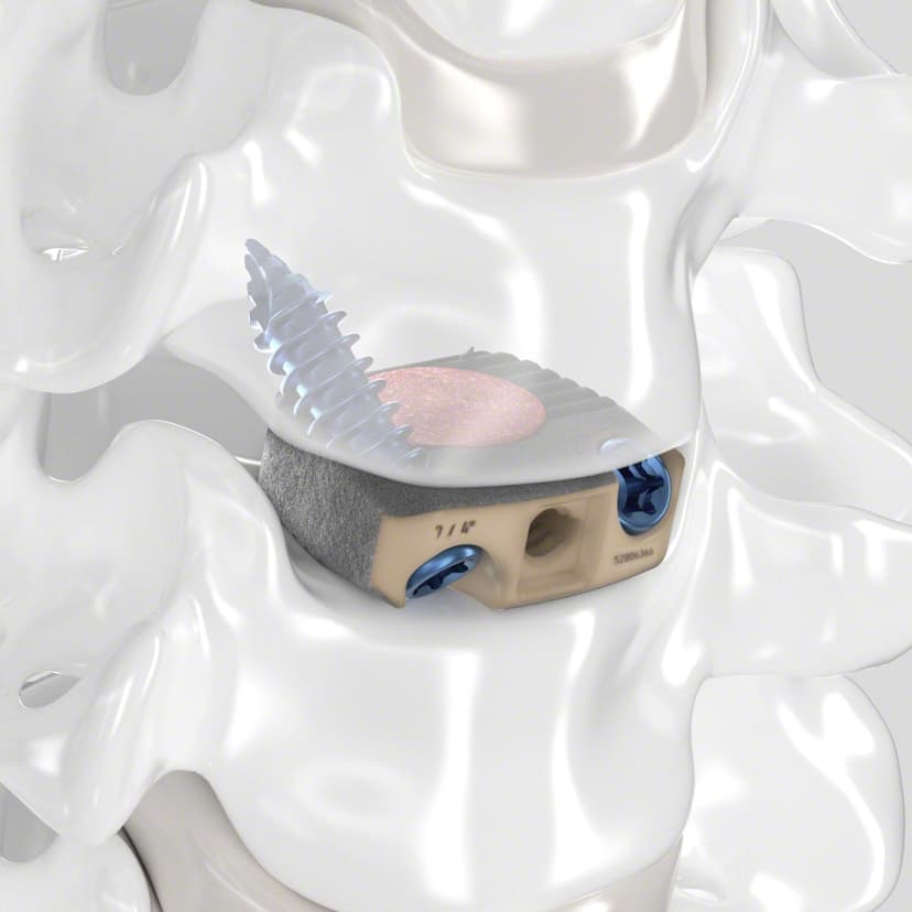 Arcadius XP C®-Product Picture