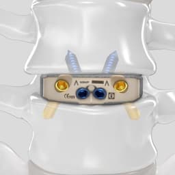 Arcadius XP L®-Produktbild