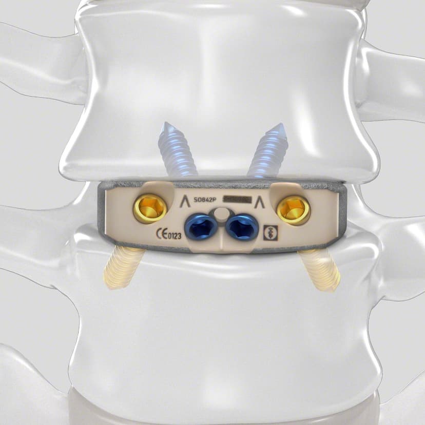 Arcadius XP L®-Produktbild