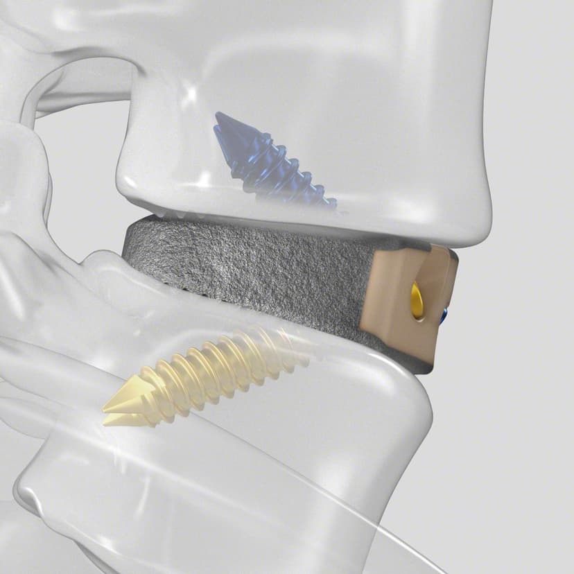 Arcadius XP L®-Produktbild