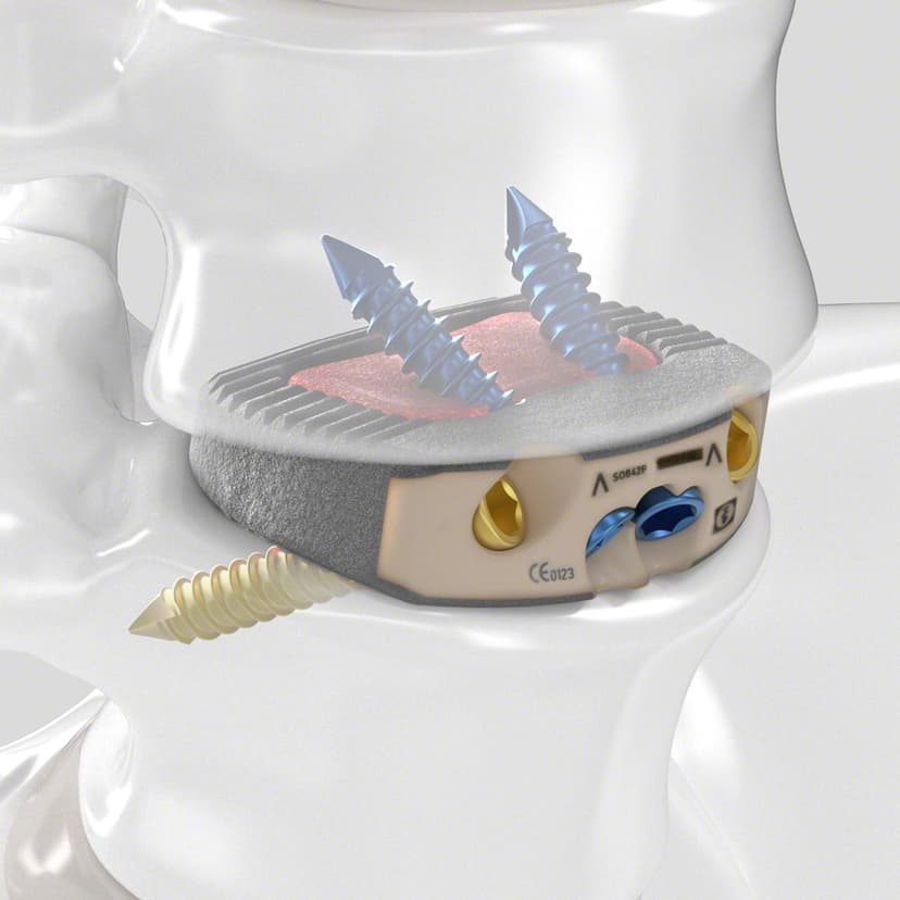 Arcadius XP L®-Produktbild