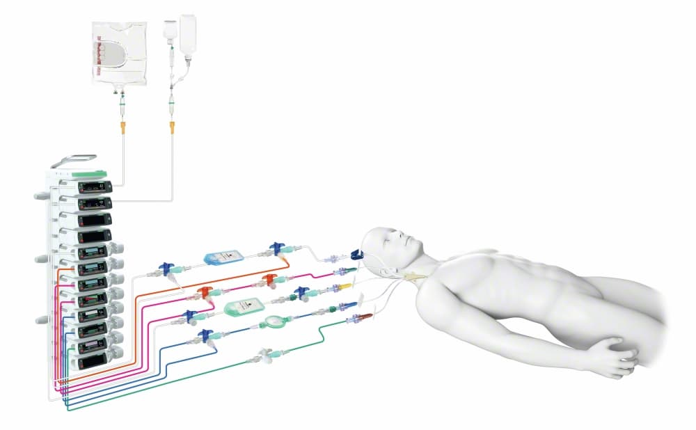 PROSET CVC LUMEN SETS-Artikelbild