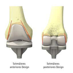 VEGA System®-Produktbild Web Vergrößerung