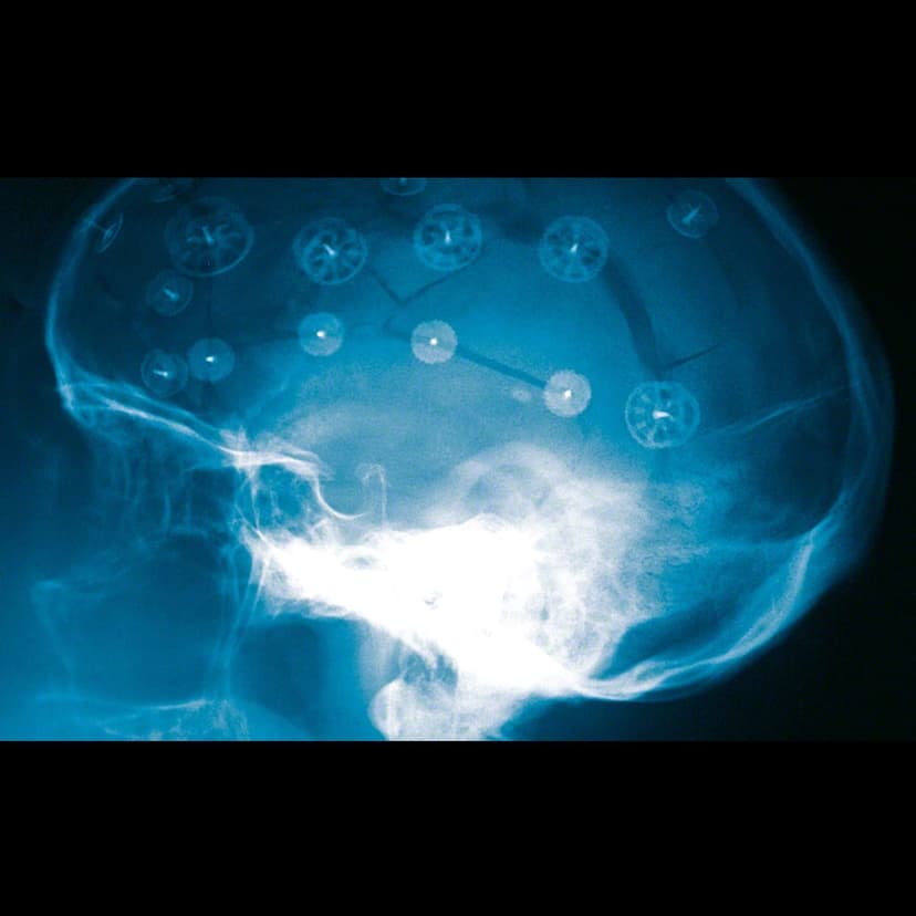 CranioFix®2-Produktbild CW Vergrößerung