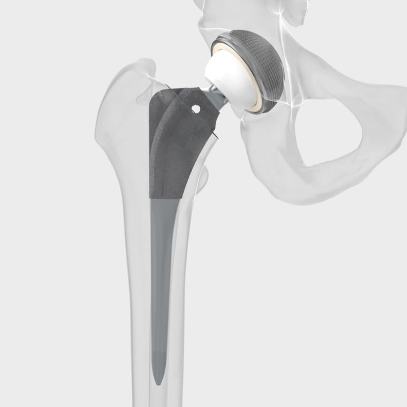 Bicontact®-Product Picture