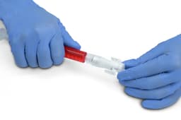 Chemfort Syringe adaptor handling-Picture of handlig a Chemfort Syringe adaptor, Syringe cap of filled Syringe